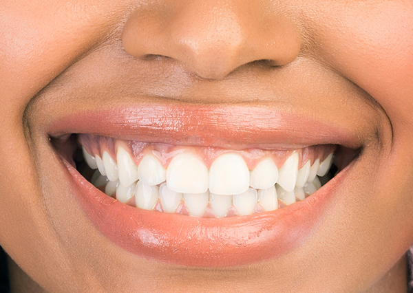 Gums